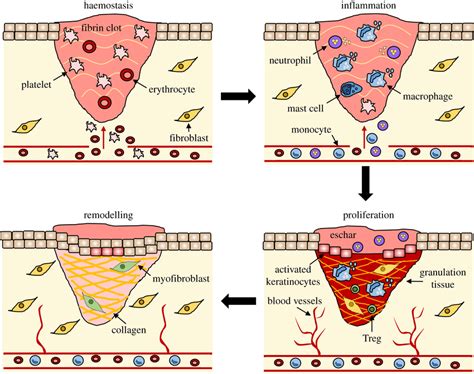 The stages of wound repair and their major cellular components. Wound... | Download Scientific ...