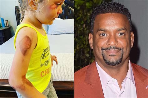 Alfonso Ribeiro Says Daughter, 4, Faces Long Recovery After Doctor ...