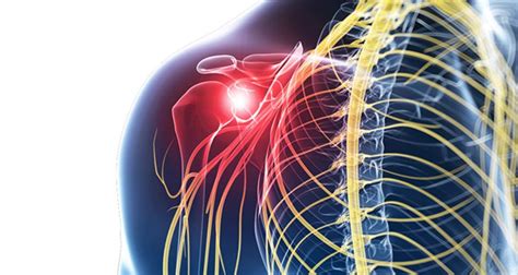 Referred Shoulder Pain - Symptoms, Causes and Treatment