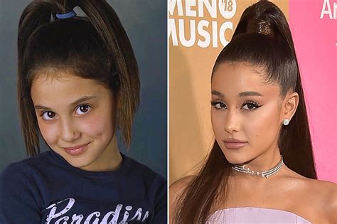 Ariana Grande Before & After: The Power of Plastic Surgery! - Demotix.com