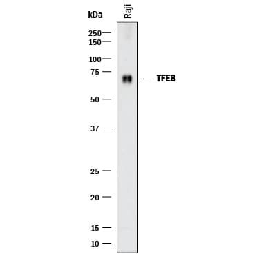 TFEB Antibodies: Novus Biologicals