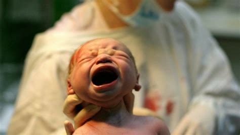 Foetus Removed From A 20-Day-Old Baby’s Stomach! What is Fetus in Fetu ...