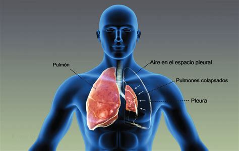 Health Condition : Symptoms, Causes, Treatment and More