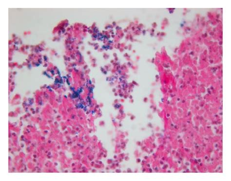 Histopathology of closure site (H&E, 50x). (a) Purulent exudate at site... | Download Scientific ...