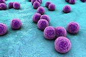 Free picture: methicillin, resistant, staphylococcus aureus, bacteria