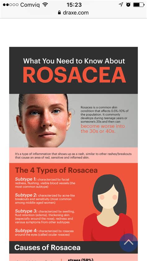 Antibiotics for rosacea side effects