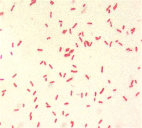 Free picture: yersinia pestis, small, gram, negative, bacillus