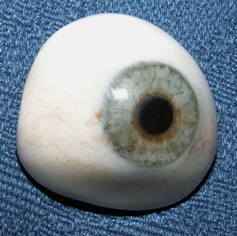 Eye, Artificial; Ocular Prosthesis; Artificial Eye