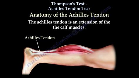 Thompson's Test Achilles Tendon Tear - Everything You Need To Know - Dr ...