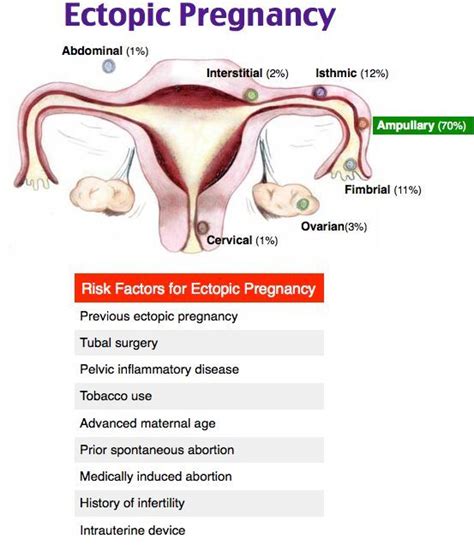 Pin on Ultrasound ️