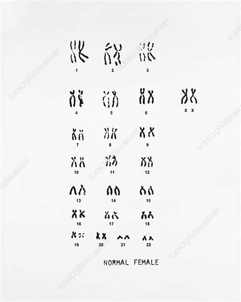 Normal Female Karyotype Stock Image C017 2419 Science Photo Library | Free Download Nude Photo ...