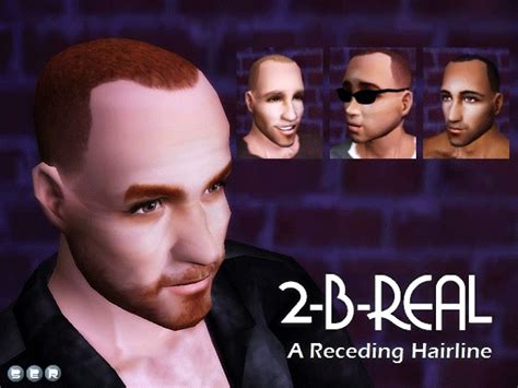 2-B-Real: Receding Hairlines are Hot! | Hairline, Star hair, Mens hairstyles