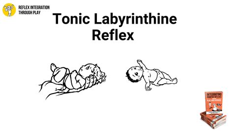 Benefits of the Tonic Labyrinthine Reflex (TLR) for Optimal Childhood Development - Reflex ...