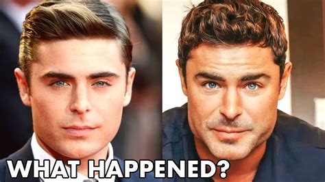 Zac Efron - New Face, Why He Looks SO DIFFERENT…(2021) - Plastic Surgery Analysis - YouTube