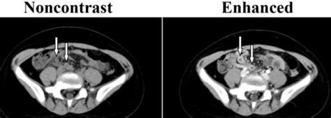 Iodine Contrast Ct Scan - Methods of Investigation | Welcome | The TIME Project : You should ...