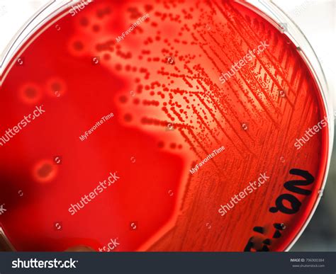 Beta-hemolysis Images, Stock Photos & Vectors | Shutterstock