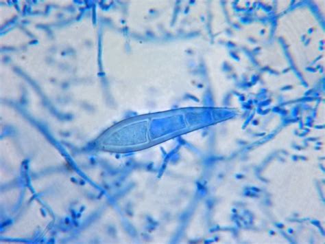 Fun With Microbiology (What's Buggin' You?): Microsporum audouinii