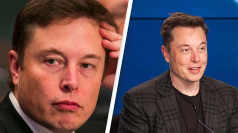 Top 48 image elon musk hair transplant - Thptnganamst.edu.vn