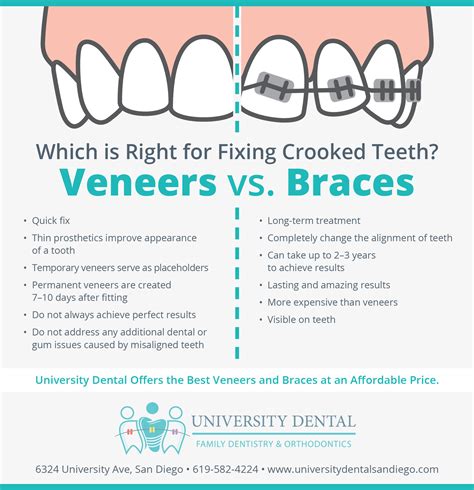 veneers-vs-braces - University Dental