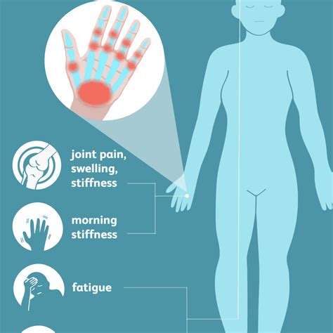 What Does Arthritis Look Like?