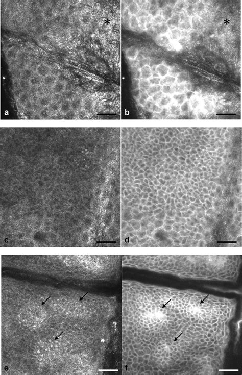 (a) RM image of the stratum granulosum 5 μm below the skin surface. (b ...