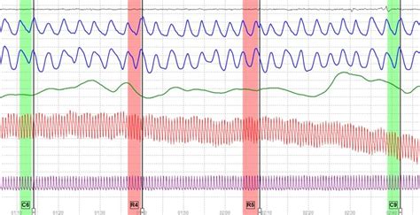 EXAMINER | True Results Polygraph Services