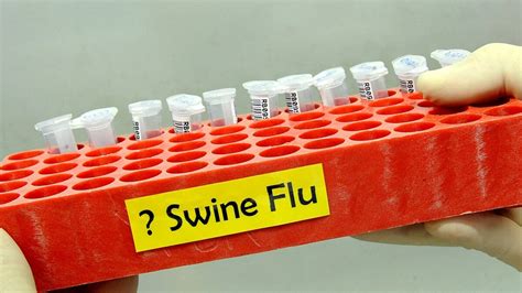 Too Early For Swine-Flu Vaccine, Expert Says