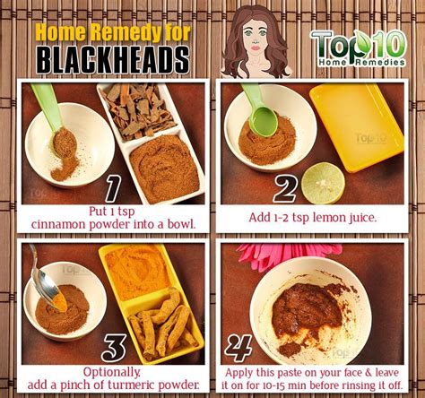 Home Remedies to Get Rid of Blackheads Fast | Top 10 Home Remedies