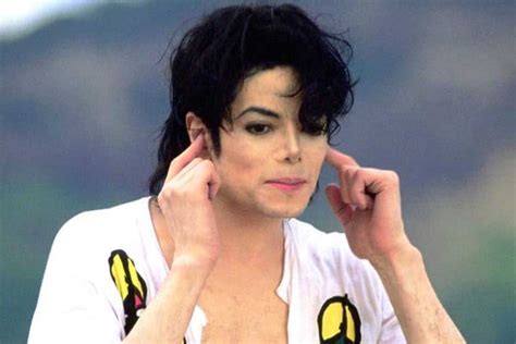 Vitiligo: Michael Jackson's Skin Condition | Skin Care Geeks