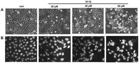 Morphological changes in HepG2 cells treated with VI-16 for 48 h. (A ...