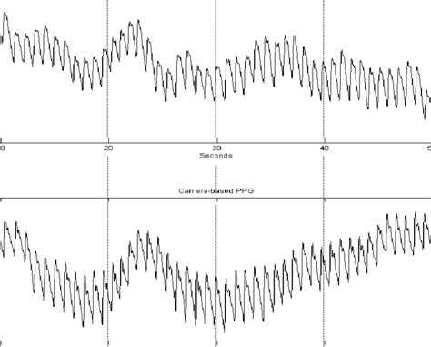 Comparison of the PPG signals obtained using a conventional (top) PPG ...