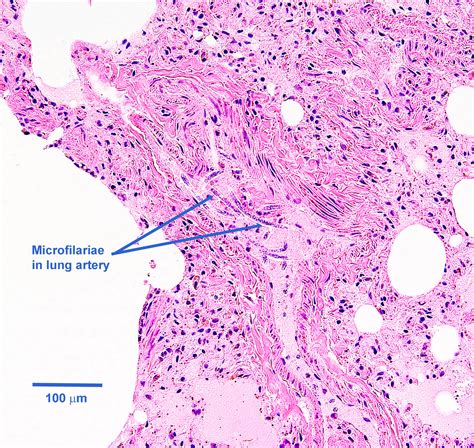 Dirofilaria immitis - Learn About Parasites - Western College of ...