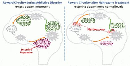 Naltrexone and Alcohol - What Is Pharmacological Extinction? - Fit Recovery