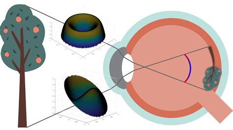 Understanding Ocular Wavefront aberrations - Myopia Profile
