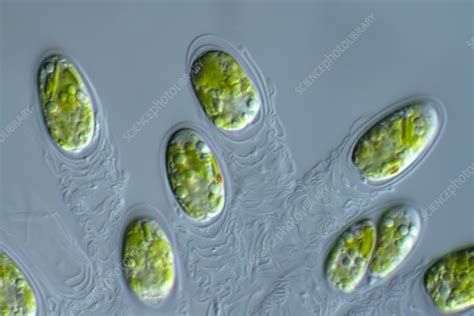 Tetraselmis green algae, light micrograph - Stock Image - C054/5238 - Science Photo Library