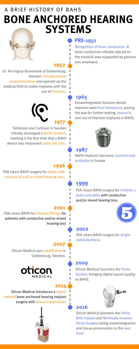 Infographic: A Brief History of Bone Anchored Hearing Systems (BAHS) | Bone Anchored Hearing ...