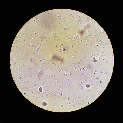 View in the Microscope on Trichomonas Painted with Methylene Blue ...