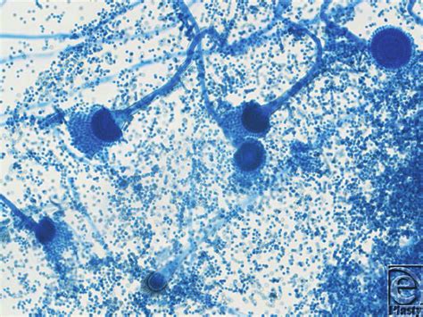 Light microscopy of Aspergillus spp with lactophenol cotton blue stain... | Download Scientific ...