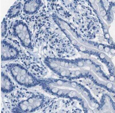 Enteropeptidase/Enterokinase Antibodies: Novus Biologicals