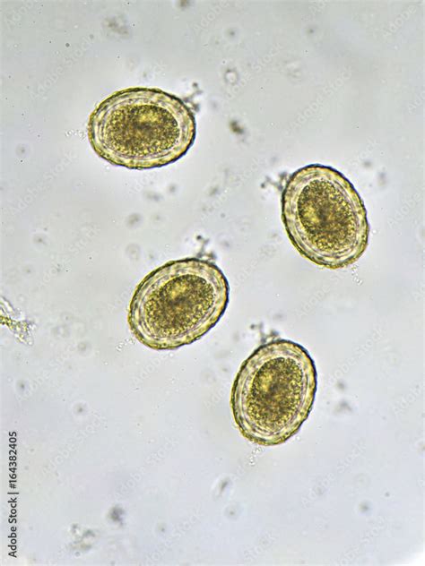 Roundworm In Stool