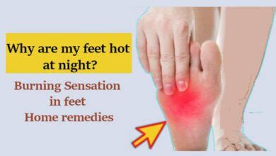 Burning Sensation in Feet Home Remedies and Prevention