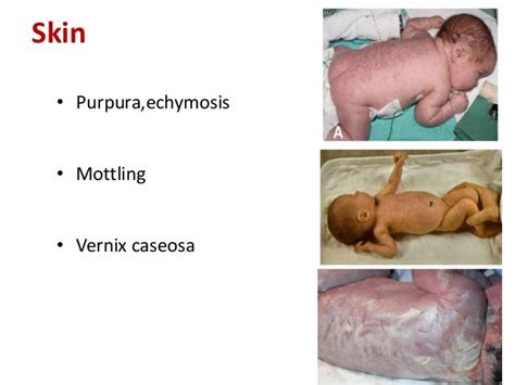 Examination of newborn.