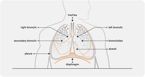 Definition - Bronchiectasis