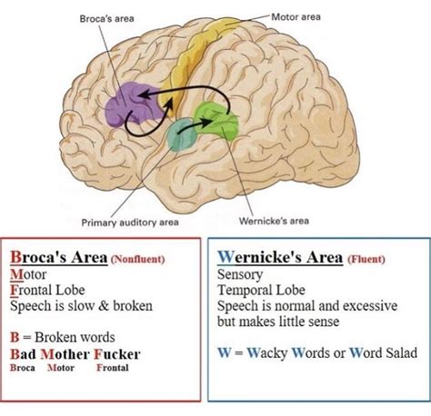 Broca’s vs Wernicke’s | Speech language pathology grad school, Speech ...