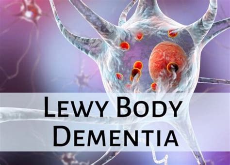 Lewy Body Dementia: All You Need To Know - ReaDementia