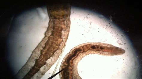 Biology - Cool Microscopic Pond Water Organisms! Oligiochaete Worm ...