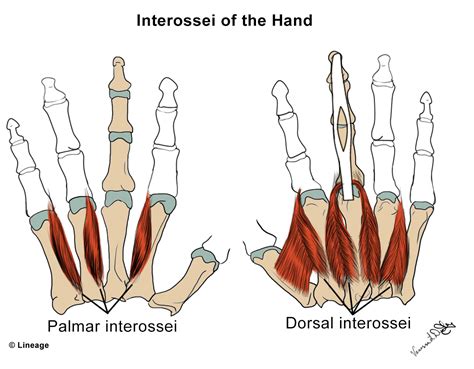 Intrinsic Hand Muscles - MSK - Medbullets Step 1