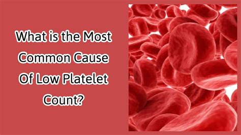 What is the Most Common Cause Of Low Platelet Count - YouTube