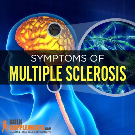 Multiple Sclerosis (MS): Symptoms, Causes & Treatment