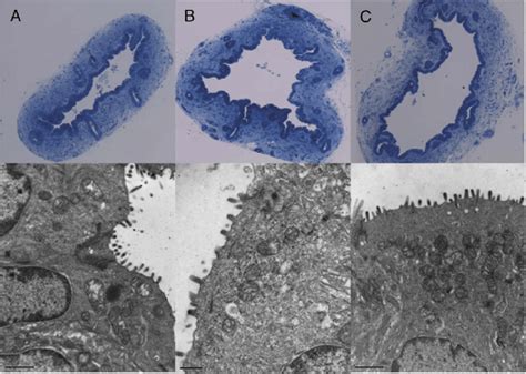 Light microscopy (top) and EM (bottom) of bile ducts after 2 hours ex... | Download Scientific ...